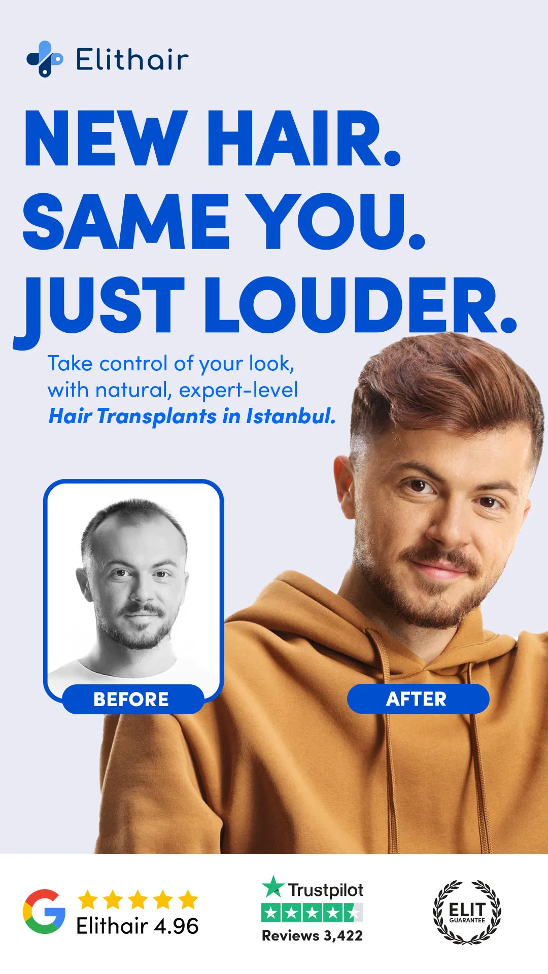 Receding? Not the vibe.